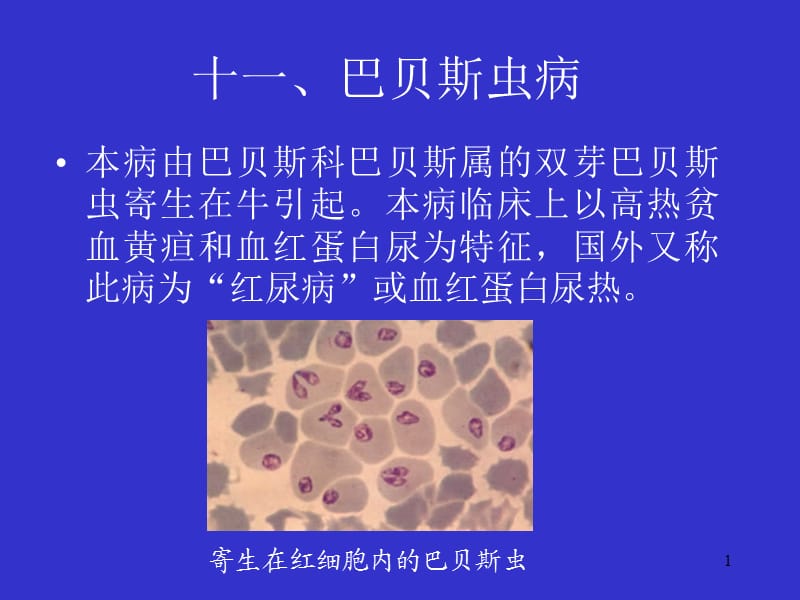 巴贝斯虫病ppt课件_第1页