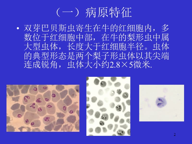 巴贝斯虫病ppt课件_第2页