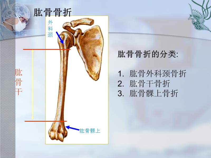 肱骨骨折的护理ppt课件.ppt_第3页