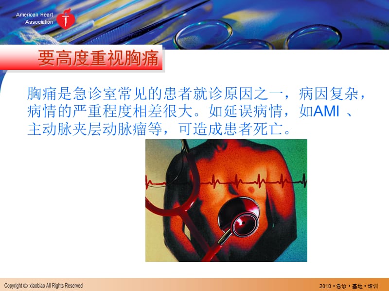 高危胸痛的急救护理ppt课件.ppt_第2页