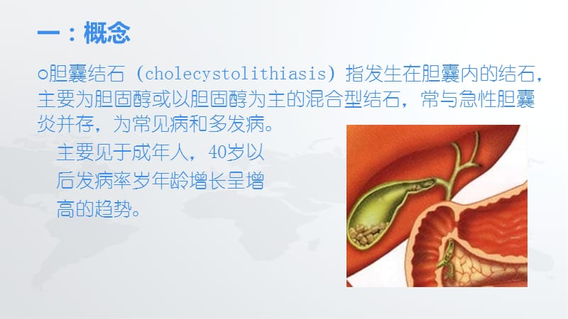 胆囊结石的护理ppt课件.ppt_第3页