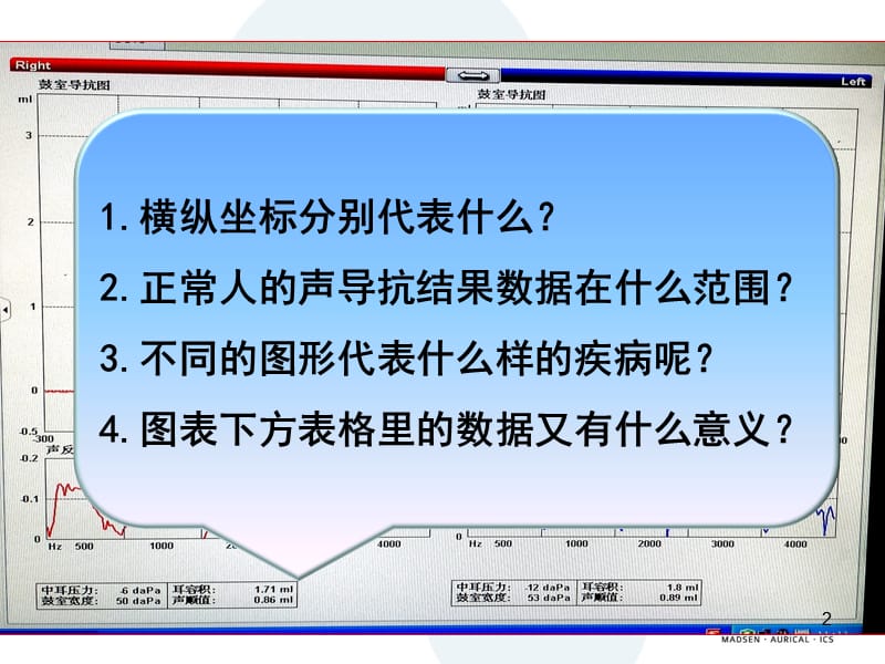 声导抗知识ppt课件_第2页