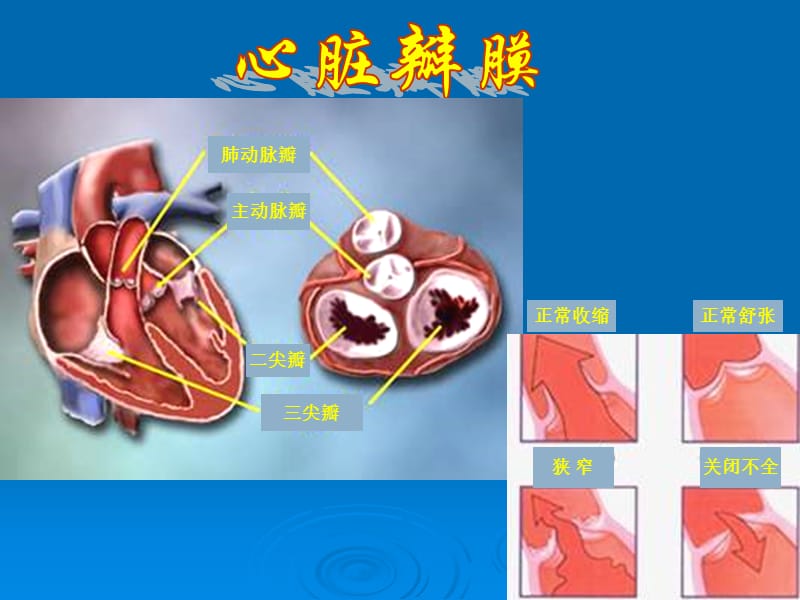 心脏瓣膜病围手术期护理.ppt_第3页