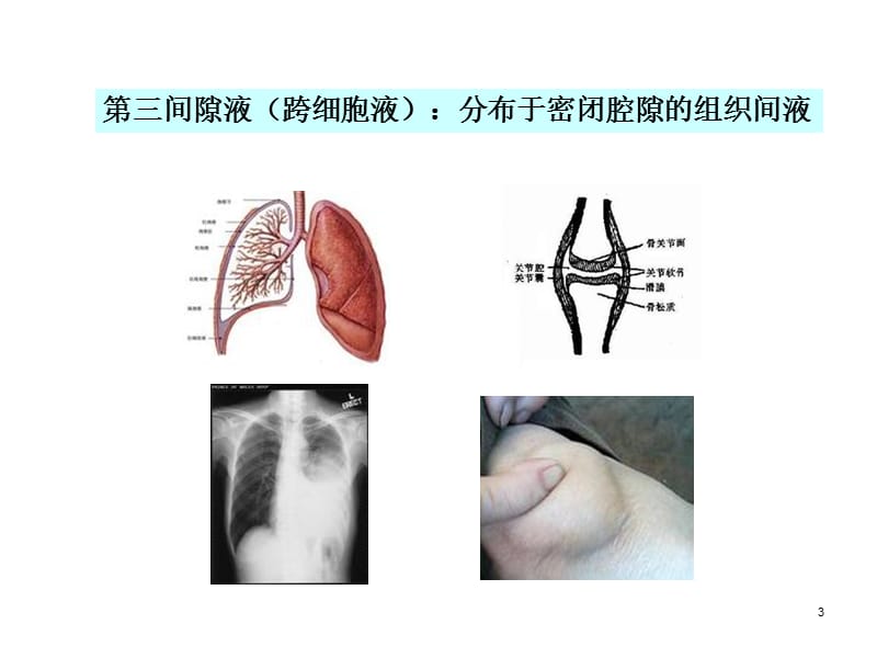 生理水电解质代谢紊乱ppt课件_第3页