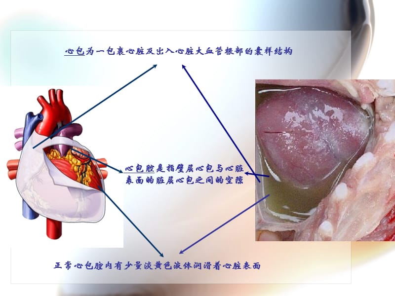 心包填塞、胸腔积液的观察及护理ppt课件.ppt_第3页