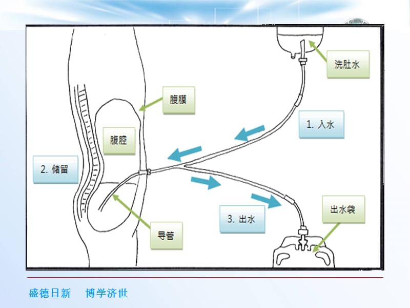 腹膜透析相关护理课件_.ppt_第3页