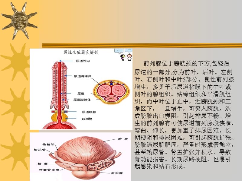 病人围手术期护理ppt课件.ppt_第3页