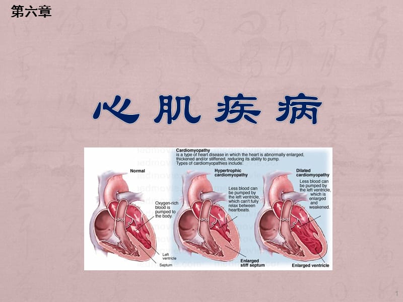 心肌疾病ppt课件_第1页