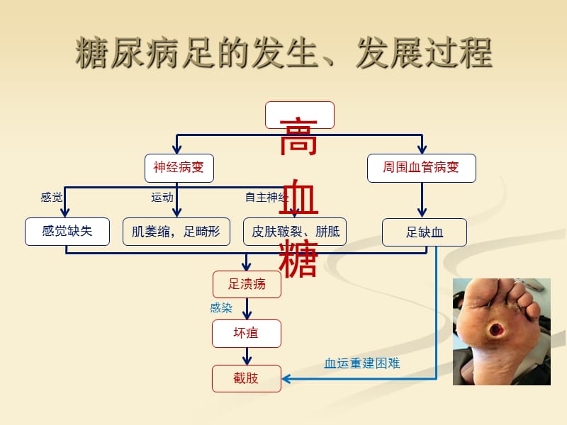 中国糖尿病足诊治指南_第2页