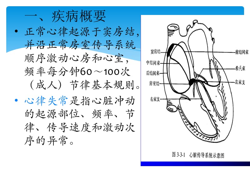 心律失常病人护理_第2页