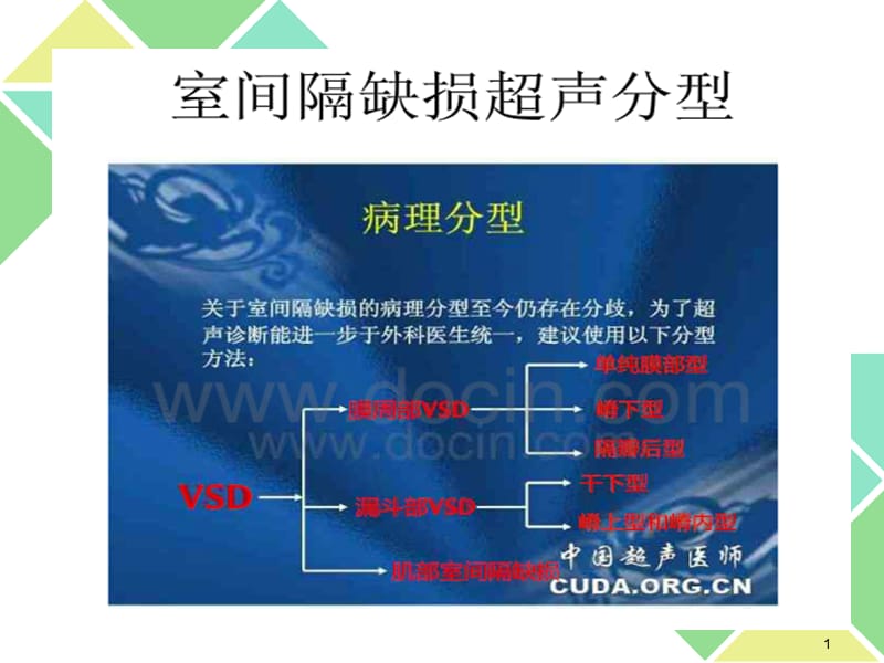 室间隔缺损分型及相关鉴别ppt课件_第1页