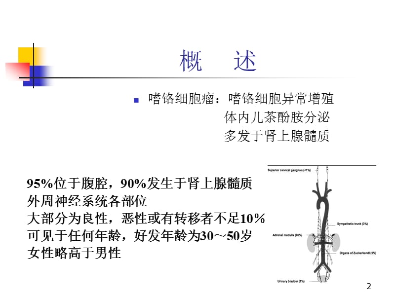 嗜铬细胞瘤手术的麻醉管理现状ppt课件_第2页