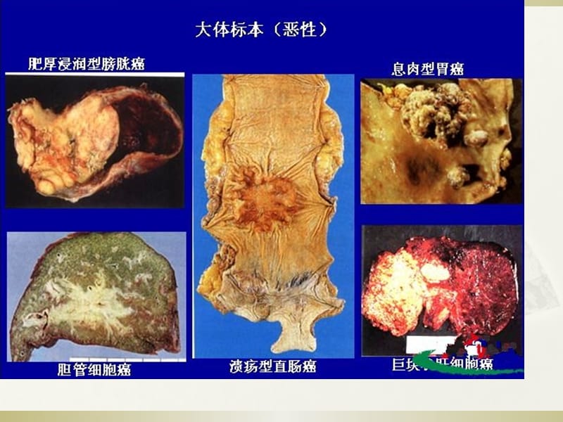 肿瘤学概论_第3页