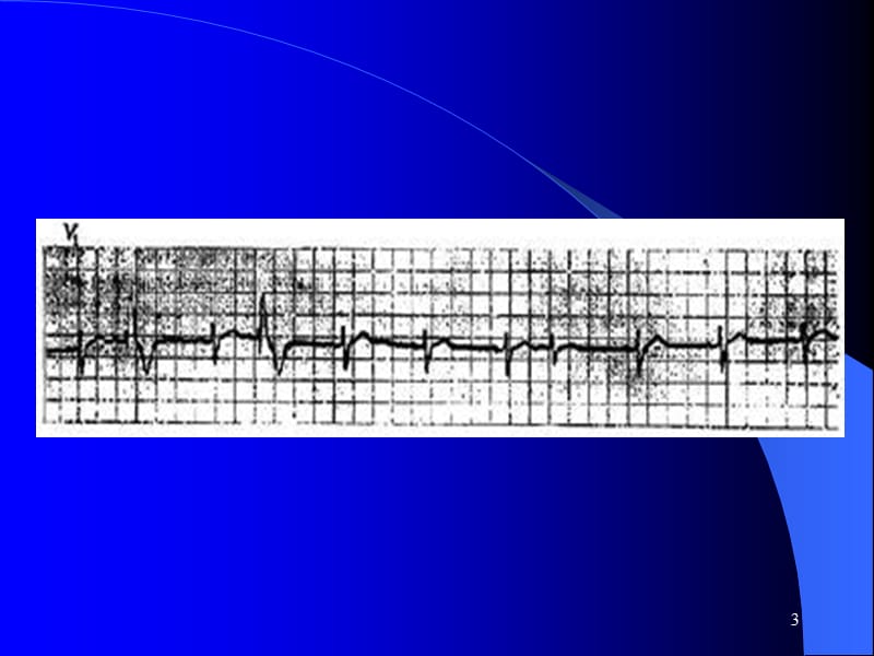 心律失常诊治ICUPPT课件_第3页