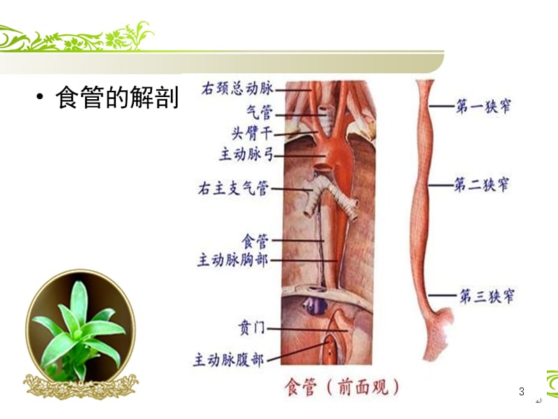 食管癌护理查ppt课件_第3页