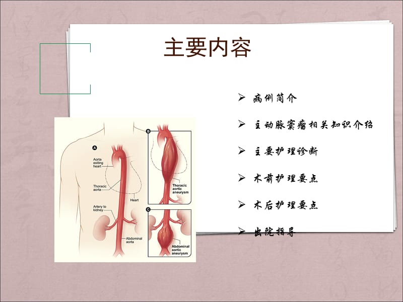 主动脉夹层动脉瘤围手术期教学查房_第2页