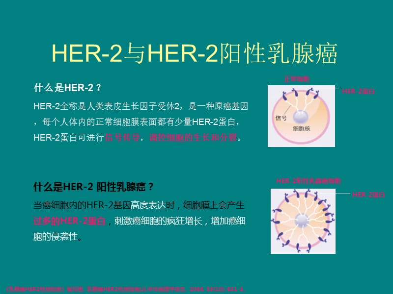 走进HER-2阳性乳腺癌_第3页