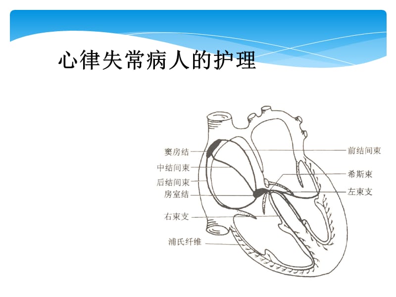 心律失常病人的护理_第1页