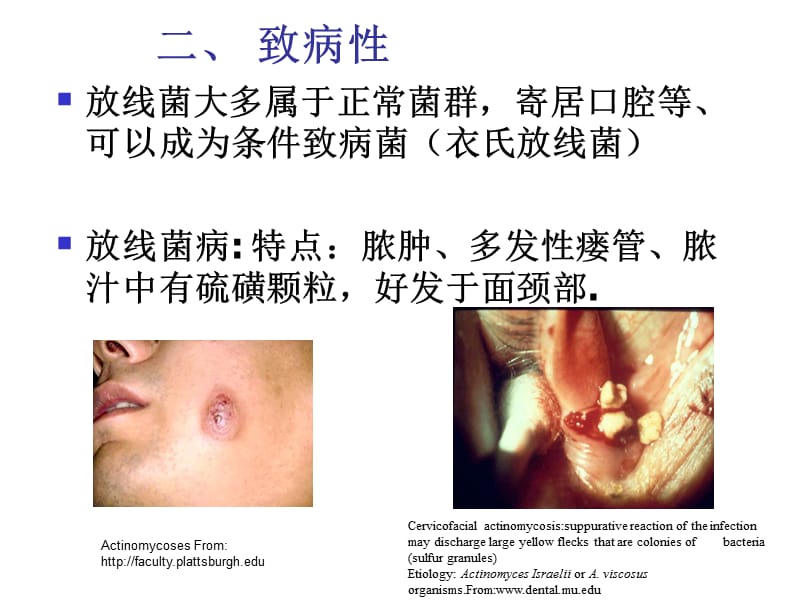 医学微生物学课件-第19章放线菌属与诺卡菌属.ppt_第2页