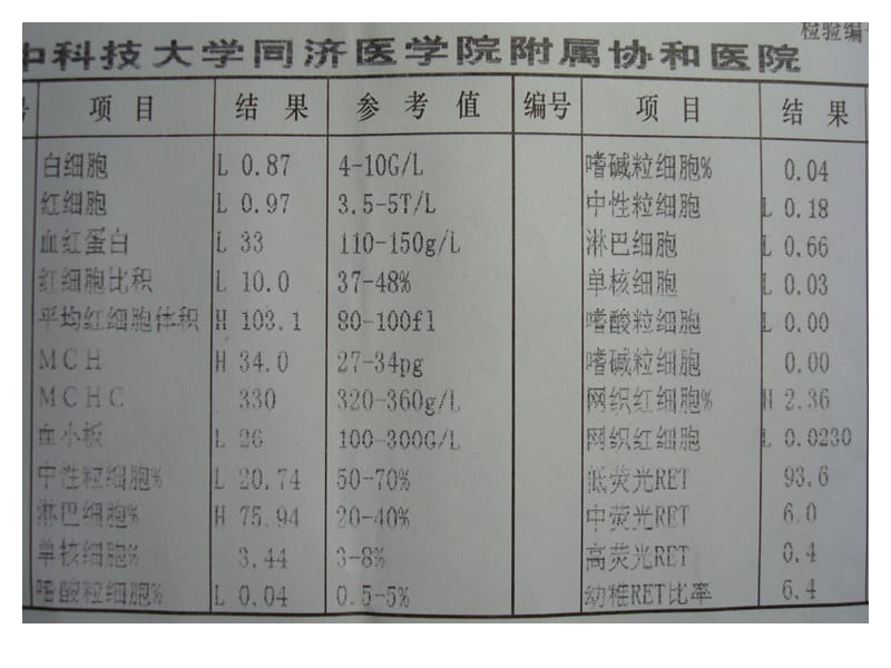 临床血液学和血液学检验-贫血(MA).ppt_第2页