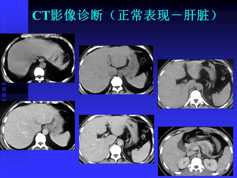 临床执业医师考试大纲(医学影像学).ppt_第2页