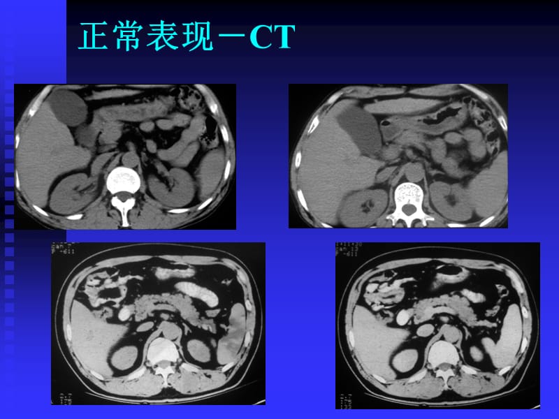 临床执业医师考试大纲(医学影像学).ppt_第3页