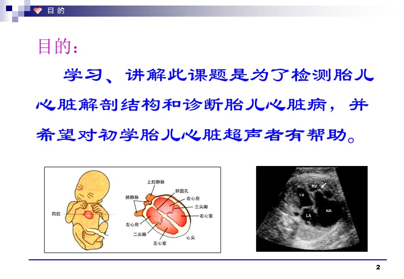 胎儿心脏解剖结构的超声判定ppt课件_第2页