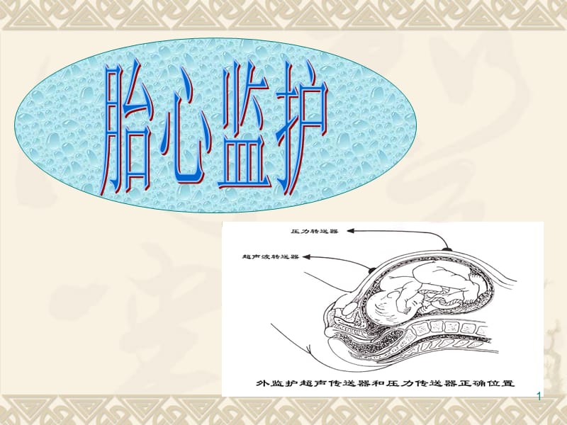 胎心监护教学ppt课件_第1页