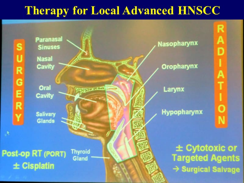 头颈部肿瘤放疗皮肤粘膜及涎腺的放射性损伤及其处理ppt课件_第2页