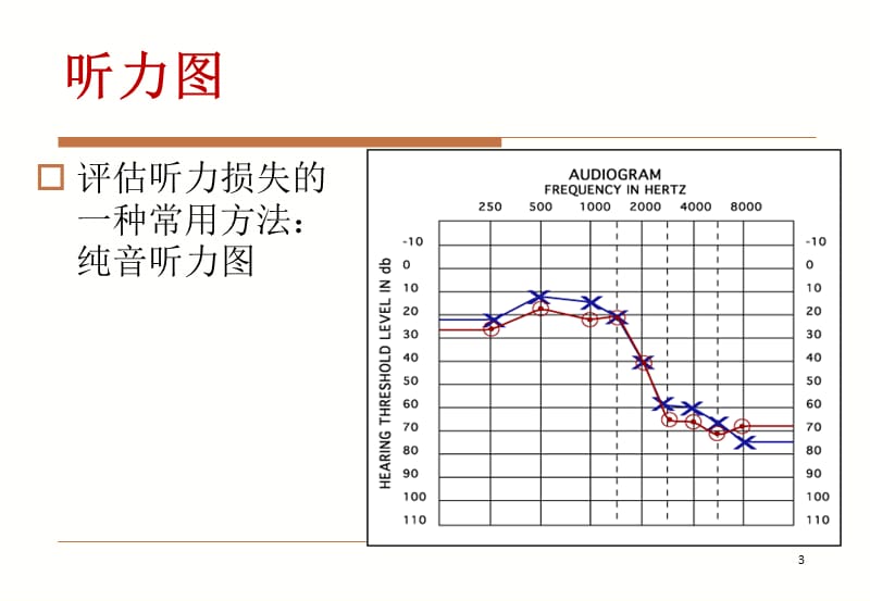 听力损失的原因ppt课件_第3页