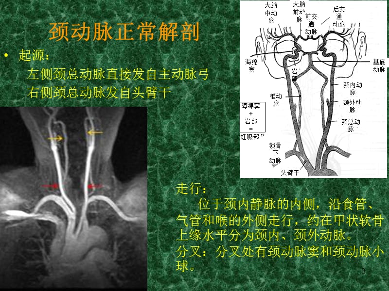 头颈部血管解剖ppt课件_第3页