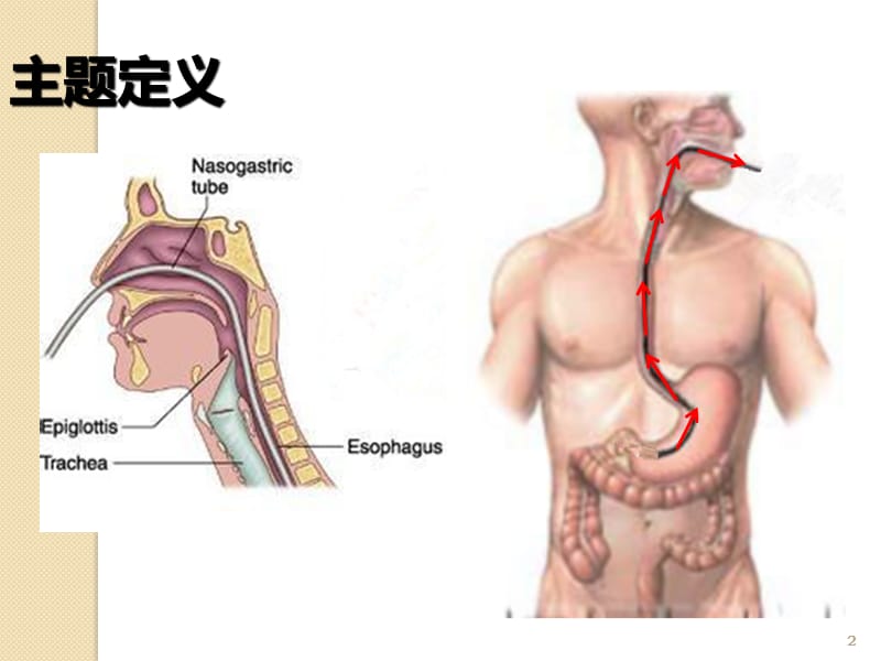 提高患者胃肠减压期间舒适度ppt课件_第2页