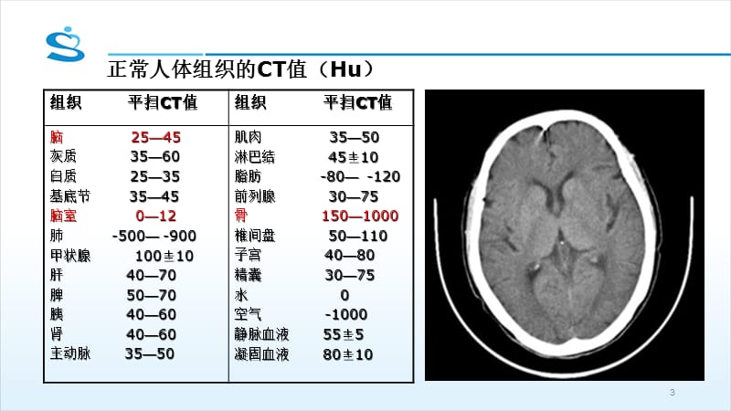 头颅CT基本知识及神经外科常见疾病CT读片ppt课件_第3页