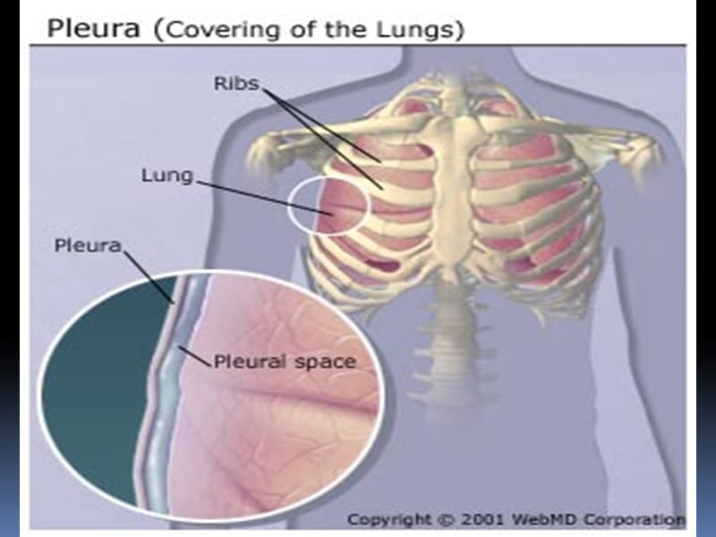 胸腔积液课件_第3页