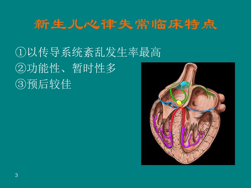 新生儿危重心律失常ppt课件_第3页