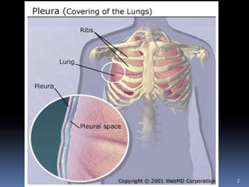 胸腔积液临床表现 ppt课件_第2页