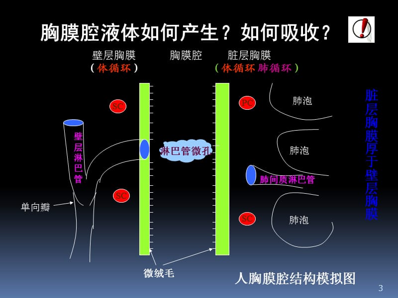 胸腔积液临床表现 ppt课件_第3页