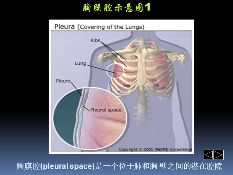 胸腔积液PPT课件_第1页