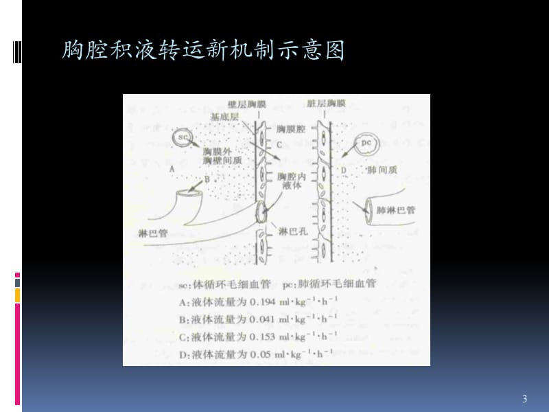 胸腔积液鉴别诊断 ppt课件_第3页