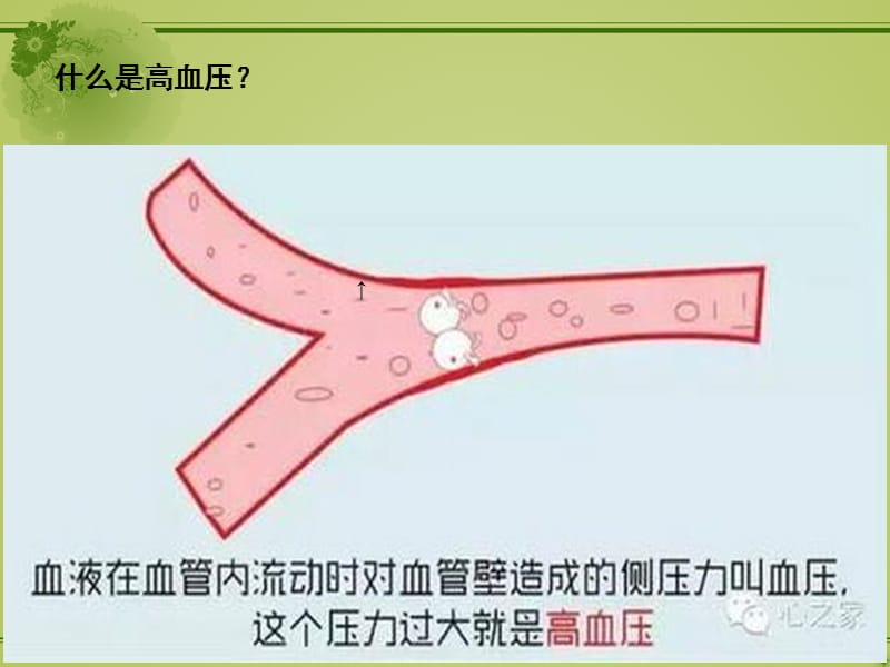 血压管理(PPT课件)_第2页