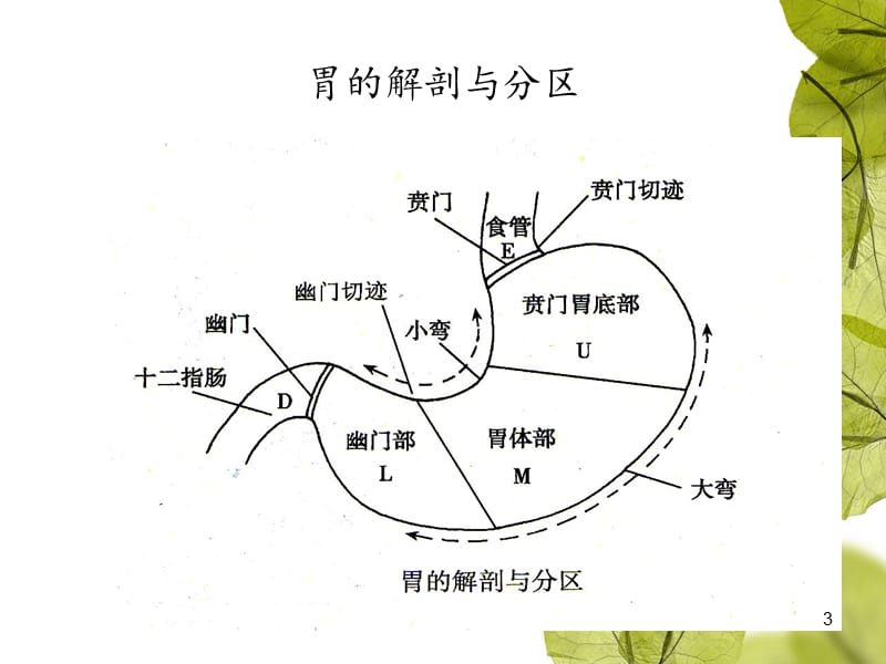 胃大部切除手术配合ppt课件_第3页