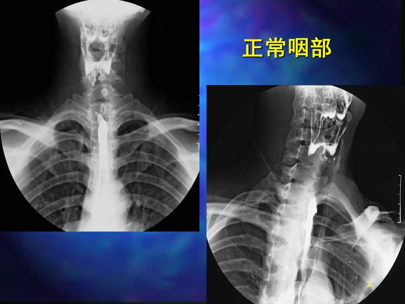 胃肠道影像图片ppt课件_第2页