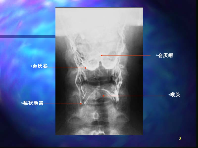 胃肠道影像图片ppt课件_第3页