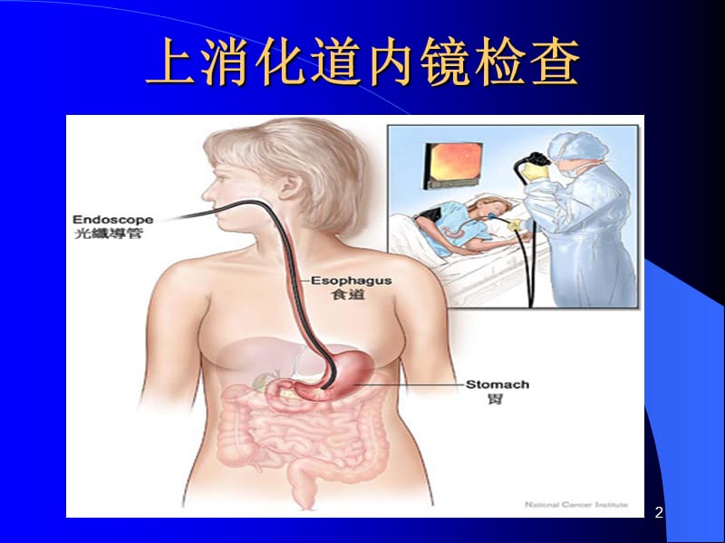 胃肠镜检查前后注意事项ppt课件_第2页