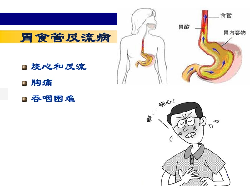 胃炎精华版ppt课件_第3页