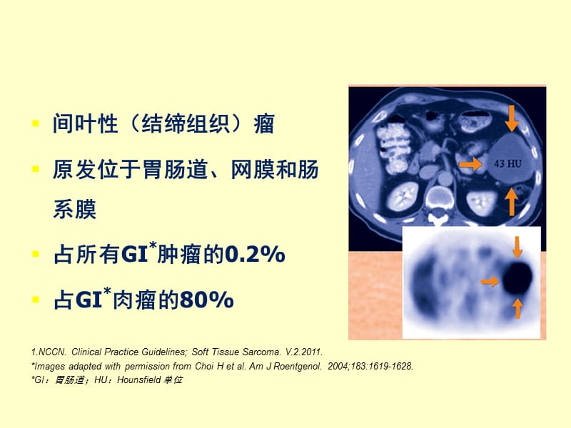 胃肠道间质瘤综合治疗经验分享ppt课件_第3页