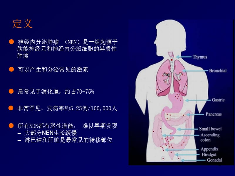 胃肠胰腺神经内分泌肿瘤ppt课件_第2页