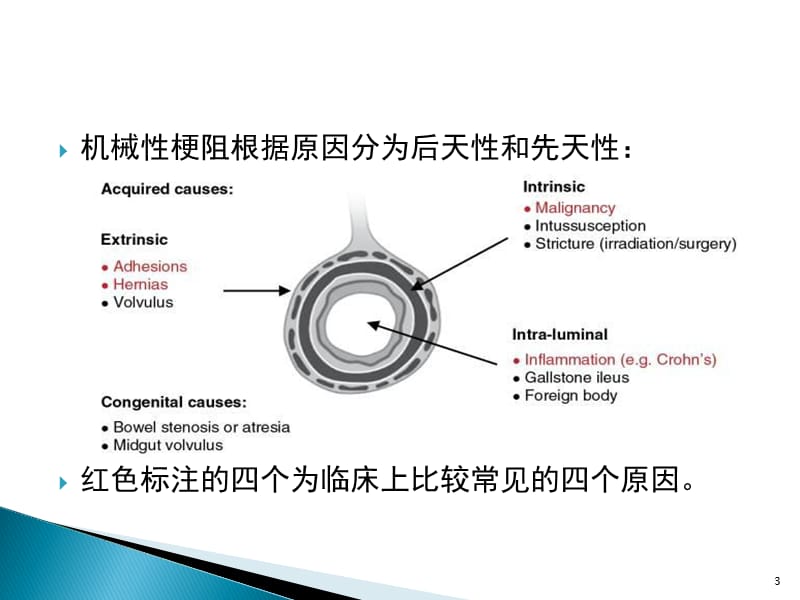 胃肠道扩张的X线诊断技巧ppt课件_第3页