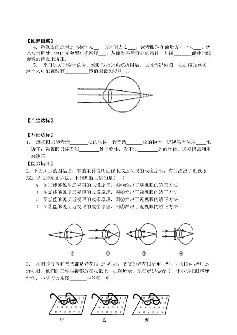 2019-2020年八年级物理上册 5.4 眼睛和眼镜导学案（新版）新人教版.doc_第2页