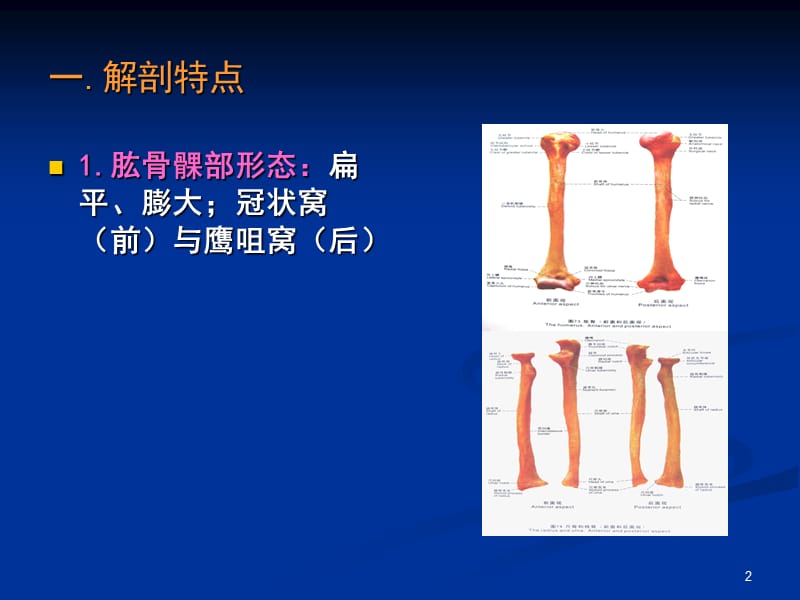 小儿肱骨髁上骨折ppt课件_第2页